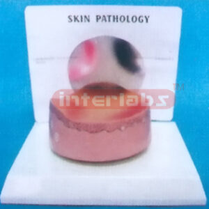 DESK-TYPE COMMON PATHOLOGIES MODEL OF ERUPTION SERIES WITH D