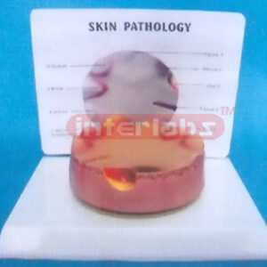 DESKTYPE COMMON PATHOLOGIES MODEL OF WOUND SERIES WITH DESCR