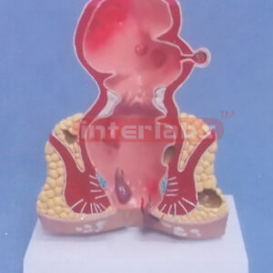 DESKTYPE COMMOM PATHOLOGIES MODEL OF RECTUM Exporter & Educa