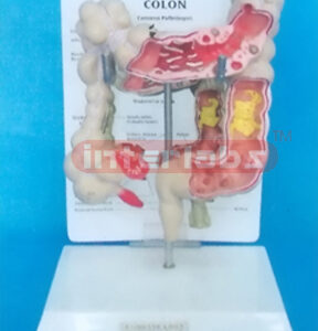 DESK TYPE COMMON PATHOLOGIES OF THE COLON MODEL WITH DESCRIP