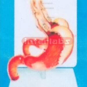 DESK-TYPE HUMAN COMMON PATHOLOGIES OF STOMACH MODEL WITH DES