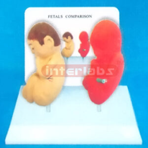 DESK-TYPE EMBRYO MODEL FOR COMPARISION DEMONSTRATING HEALTHM