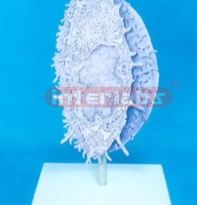 THREE DIMENSIONAL MODEL OF ULTRASTRUCTURE OF OSTEOBLAST Expo