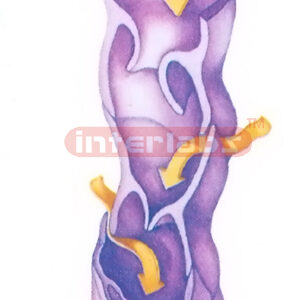 HUMAN ULTRESTRUCTURE MODEL OF LYMPHATIC VESSEL Exporter & Ed