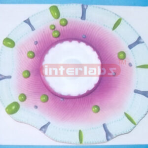 HEALTH&DISEASED CELL COMPARISON MODEL FOR TYPE 2 BIABETES Ex