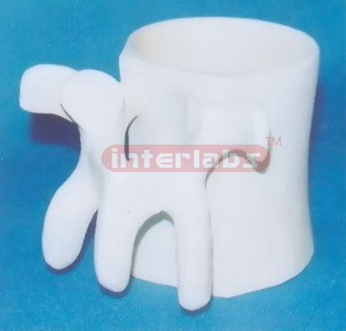 LUMBAR VERTEBREA MUG Exporter & Educational Laboratory Equip